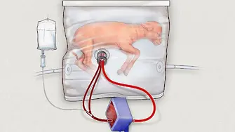 Създадоха изкуствена майчина утроба (СНИМКИ+ВИДЕО)