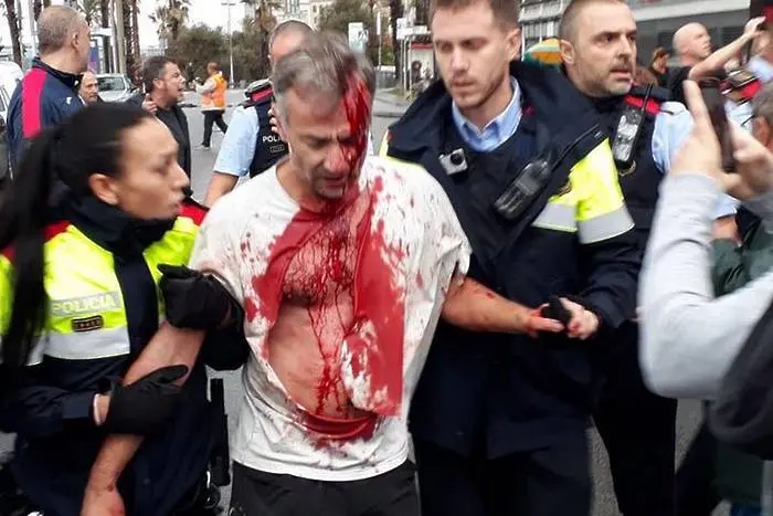 761 ранени при ожесточените сблъсъци в Каталуня, вотът окървавен (СНИМКИ, ВИДЕО)