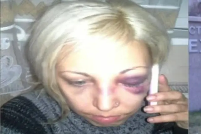 Жена твърди, че е пребита от полицай в метрото (обновена)
