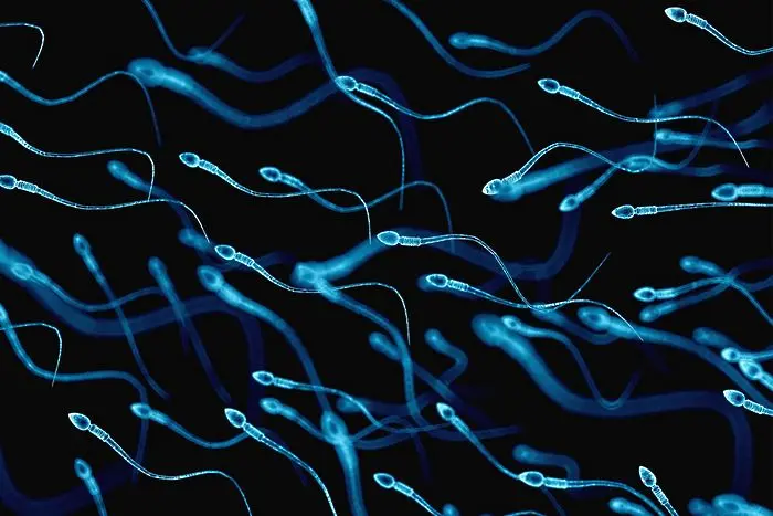 Мръсен въздух - малки сперматозоиди?