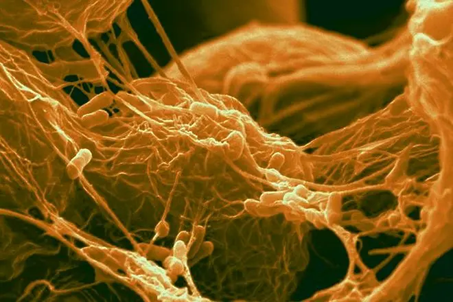 Наномрежа със златно покритие унищожава ефикасно бактерии