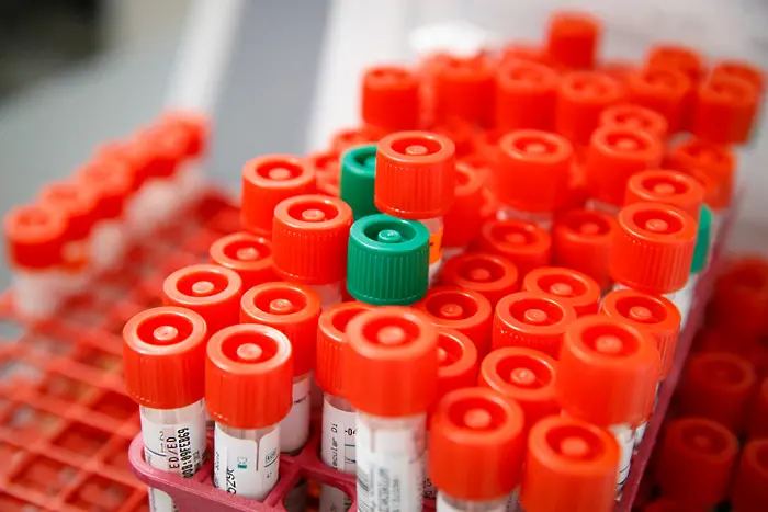 САЩ: Одобрен е първият кръвен тест за COVID-19, даващ резултат до 20 минути