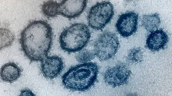 Потвърдените случаи на коронавирус за 24 часа скачат до 5,9% от пробите