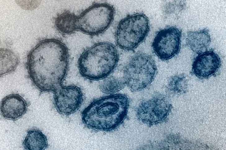 240 новопотвърдени случая на коронавирус у нас - 4,97% от направените тестове