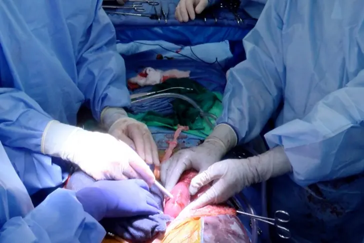 Първа трансплантация на два бъбрека от прасе на човек