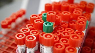 1141 са новорегистрираните случаи на коронавирусна инфекция през последното денонощие в България