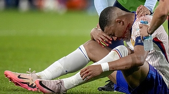 Нападателят на Франция Килиан Мбапе е със счупен нос след мача с Австрия